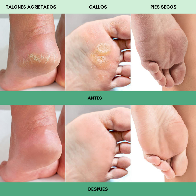 FOOT PEEL MASK - Máscara exfoliante para pies (2 paquetes)